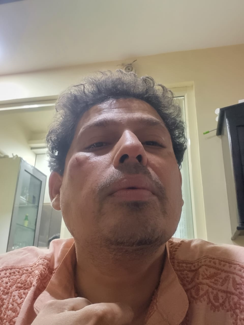 बहेड़ी सीएचसी के अधीक्षक डॉ रोहम पर हुआ जानलेवा हमला