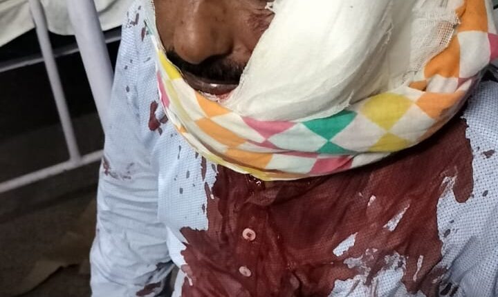 मस्जिद में नमाज पढ़ रहे नवाजी को धारदार हथियार से हमला कर घायल किया