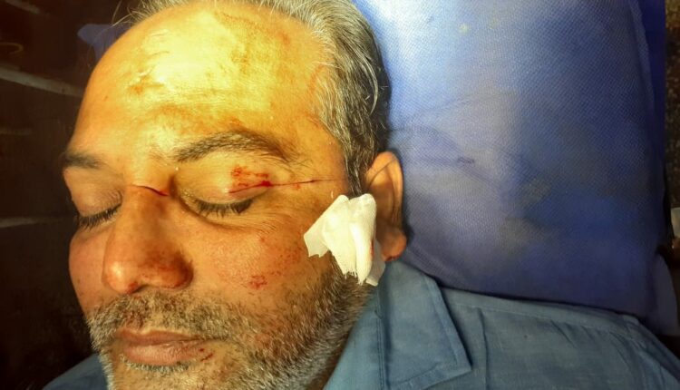 नॉवल्टी चौराहे पर माँझे की चपेट में आकर सीएमओ ऑफिस का कर्मी घायल