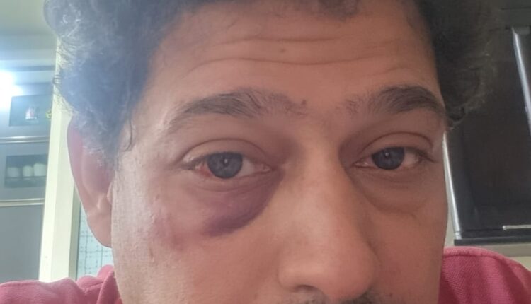 बहेड़ी सीएचसी के अधीक्षक डॉ रोहम पर हुआ जानलेवा हमला