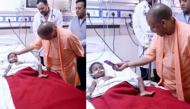 सड़क हादसे के घायलों को देखने केजीएमयू पहुंचे सीएम योगी